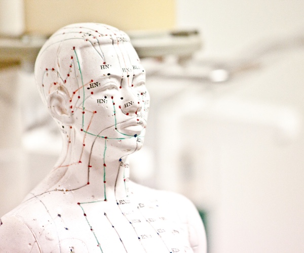 Akupunktur als Teil der TCM