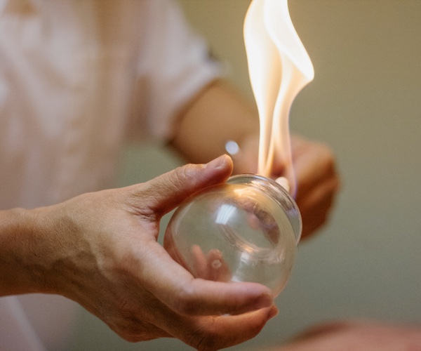 Schröpfen als Teil der TCM