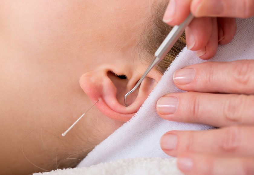 Ohrakupunktur in Nürnberg