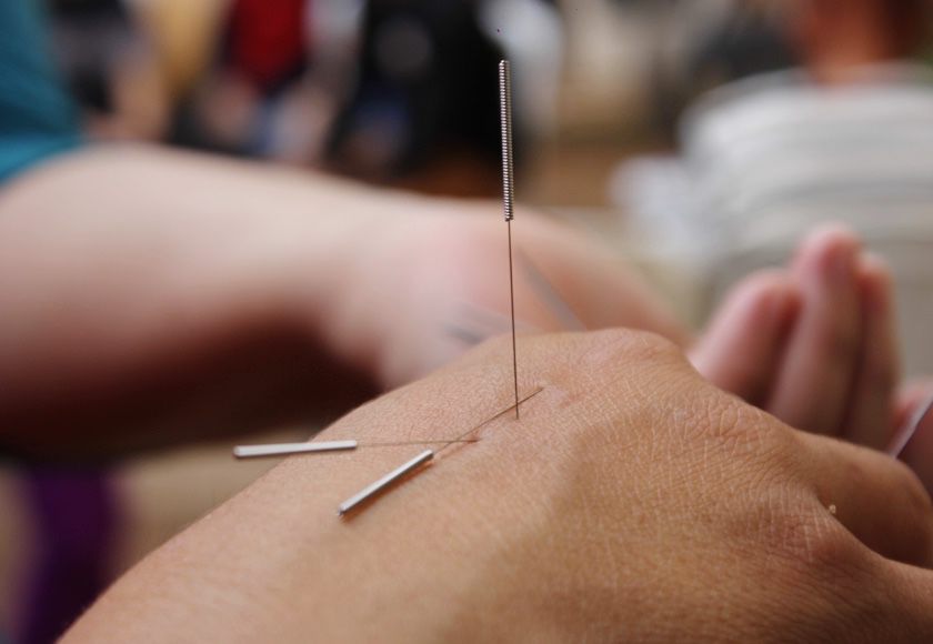 Akupunktur in Nürnberg